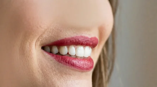 Primo piano di labbra con rossetto rosso freddo che esalta il sorriso luminoso